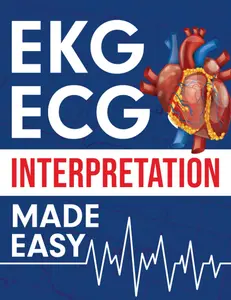 EKG ECG Interpretation Made Easy -- Nedu - Paperback