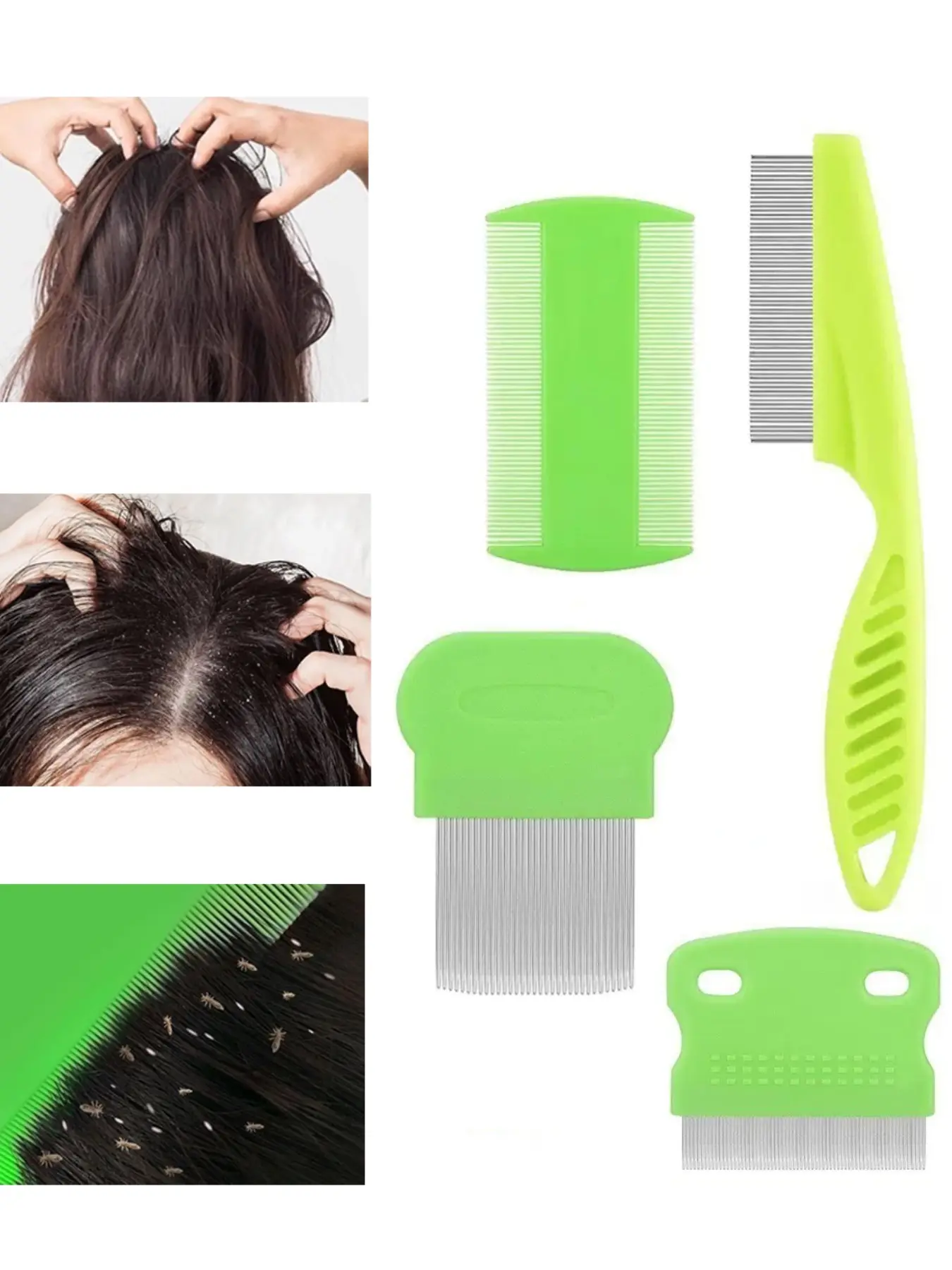 4pcs Scalp Comb Set, Dandruff Lice Detangler, Fine Tooth Massage Brush, Multi-Functional Hair Care Tool, Ideal for Women's Styling & Scalp Health, Dandruff Remover Comb, Detangling Hairbrush, Hair Tools, Detangler Combs