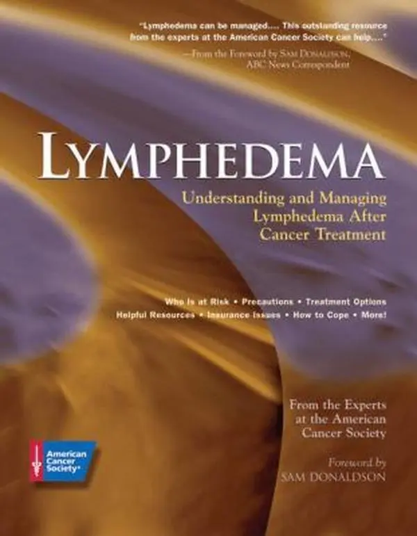 USED Book - Lymphedema: Understanding and Managing Lymphedema After Cancer Treatment by American Cancer Society (Paperback) - english