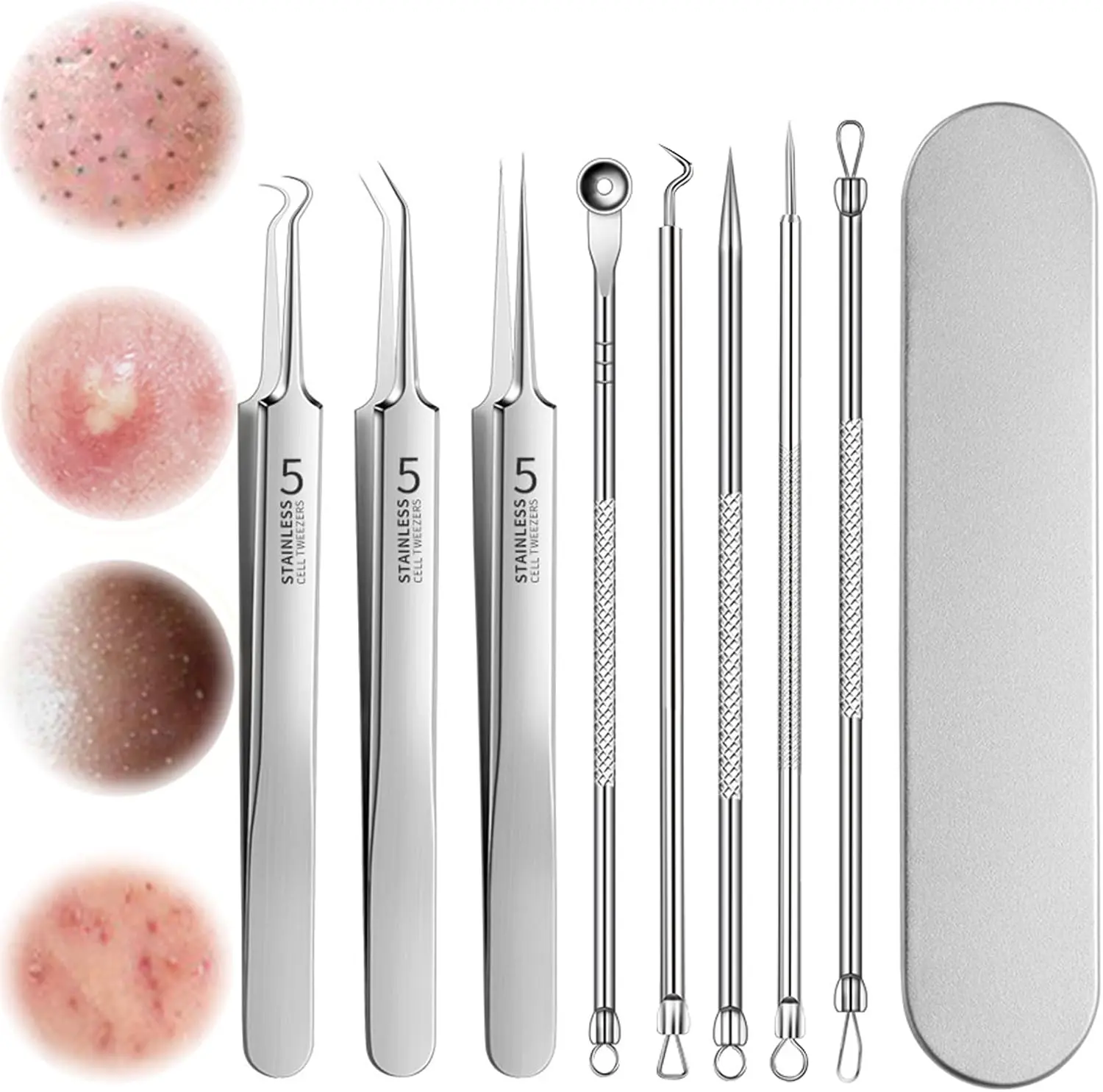 8-Piece Blackhead Extractor Kit (8pcs),Stainless Steel Pore Cleaning Tools with Anti-Slip Grip,Travel Case,Hygienic Facial Tweezers, Easy to Clean Pore Cleaning Removal Tweezer for All Skill Levels, Nose Blackhead Removal