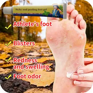 Foot cream for foot itching relief, desquamation, foot odor, toe itching, athlete’s foot, sweat reduction, softening foamy cream for cracked heels
