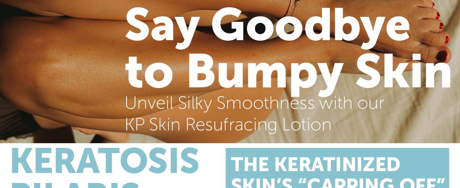 Keratosis Pilaris Treatment | Keratosis Pilaris Lotion with 10% AHA | Gentle Exfoliation For Strawberry Legs, KP & Ingrown Hairs | Smooth & Hydrating Body Lotion For Redness, Dry, Rough And Flaky Skin