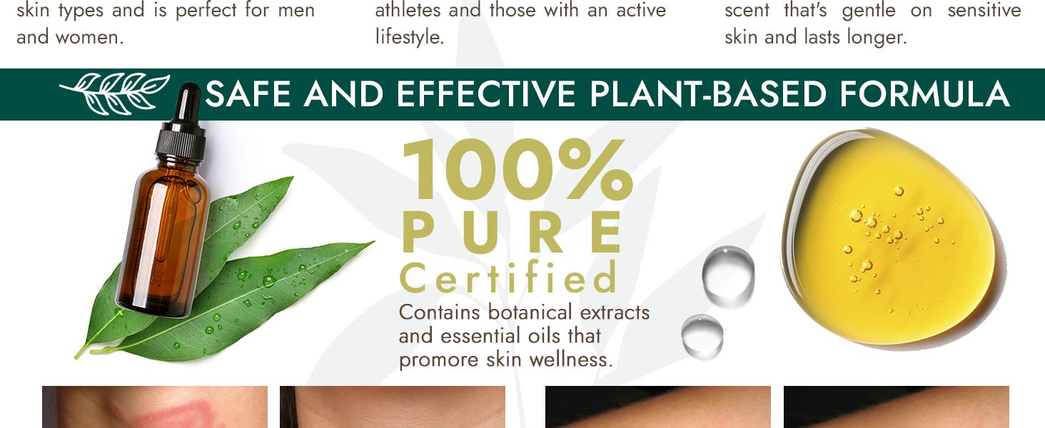 Antifungal Soap | Medicated Jock Itch Treatment, Fights Ringworm & Athlete's Foot | Soothing Tea Tree & Eucalyptus | 1% Tolnaftate for Effective Relief | Travel-Friendly with Soap Case