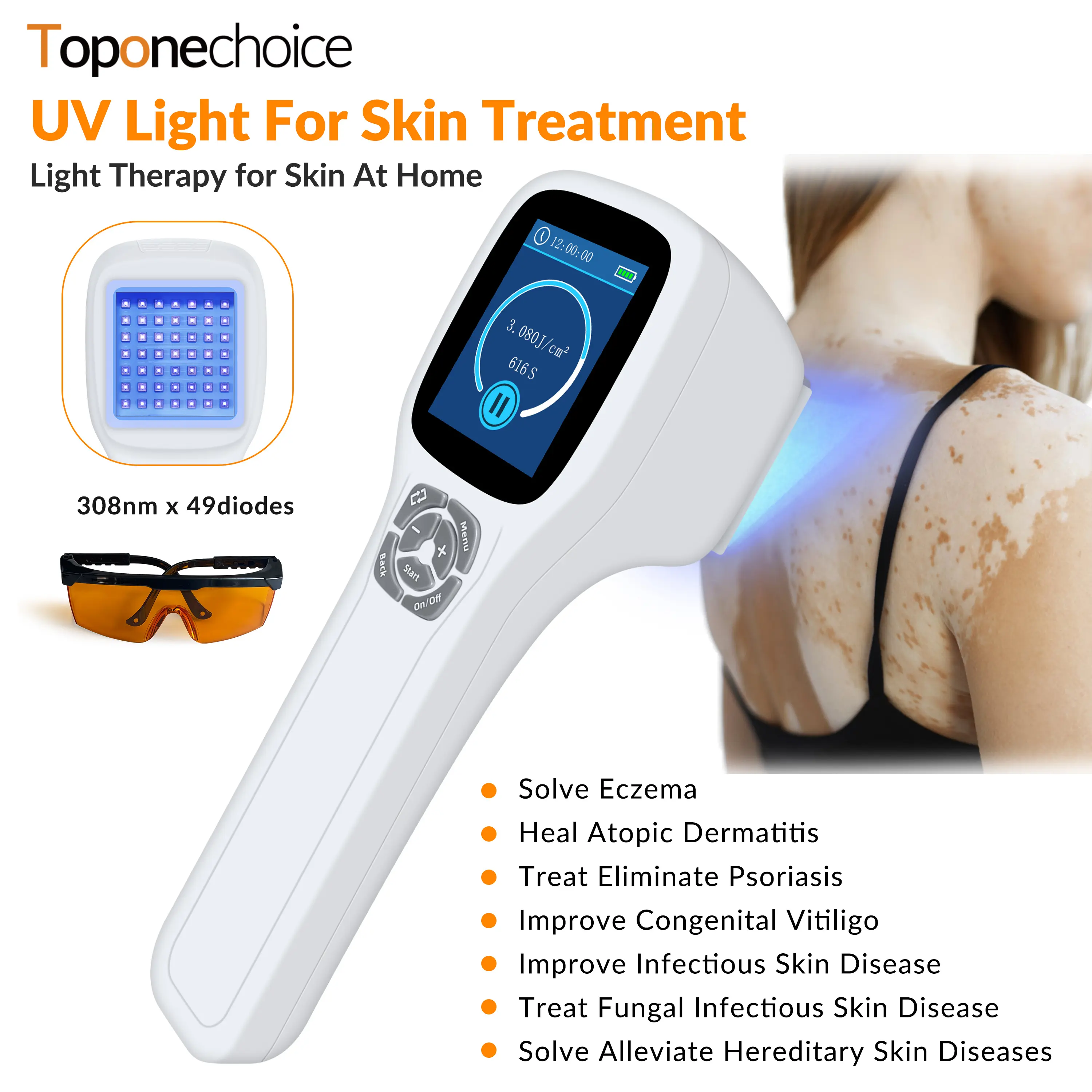 Toponechoice  308nm Excimer Phototherapy Device with 49 Diodes, Blue Light Therapy for Vitiligo, Psoriasis, Eczema, Atopic Dermatitis, Fungal Skin Disease, Hypopigmentation, Safe Targeted Home Use, Fast Recovery, Prevent Recurrence, Portable Handheld