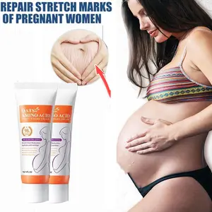 Stretch Marks Permanent Removal Cream Eliminate Body Belly Stretch Marks Swelling Marks Remove Skin Cracks Repair Firming Care