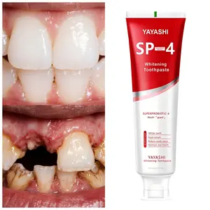 Oral Toothpaste - SP-4 Toothpaste - Advanced oral care with probiotics, long-lasting fresh breath, protect tooth enamel Effective niacinamide toothpaste