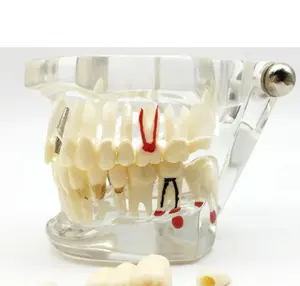 Dental Model: Transparent Removable Tooth Model for Restoration