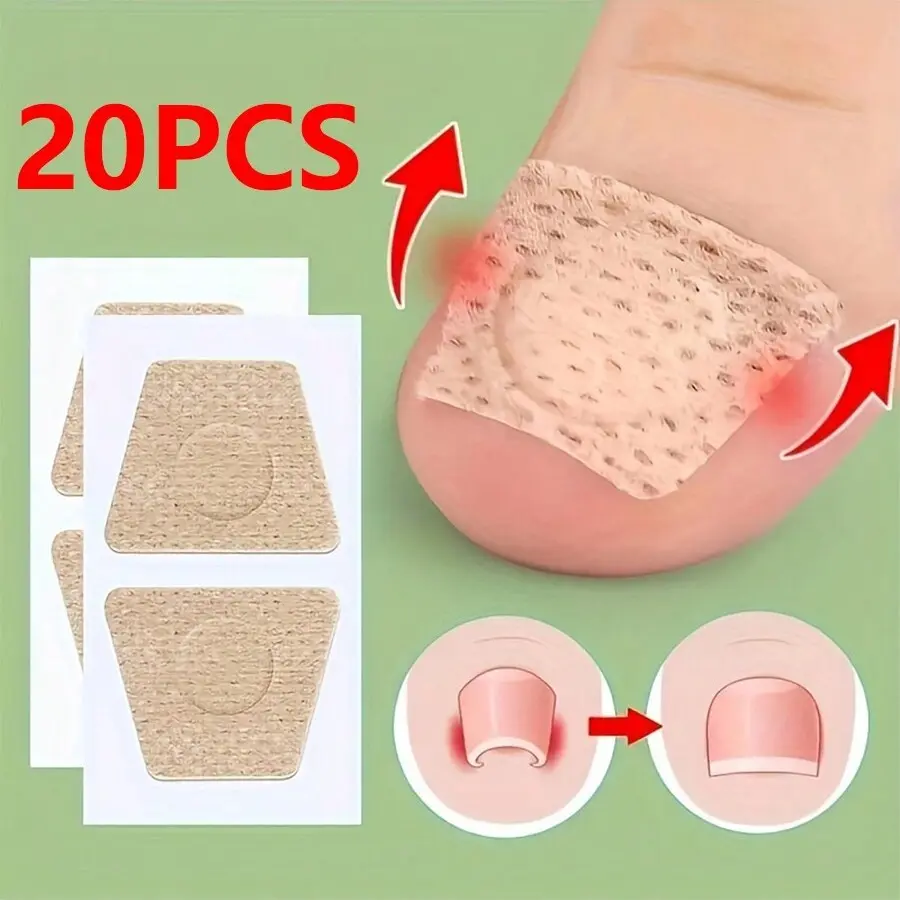 20 Patches Ingrown Toenail Correction, Solid Form Fabric Mask Type, Foot Care, Gentle, Recyclable, No Alcohol or Aerosol, Made in China, Single Item, Pedicure Tool, Ingrown Toenail Tool
