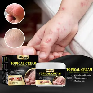 Hand and Foot Itch Relief Cream Skin Dryness Itching Mosquito Bite Itch Repair Balm