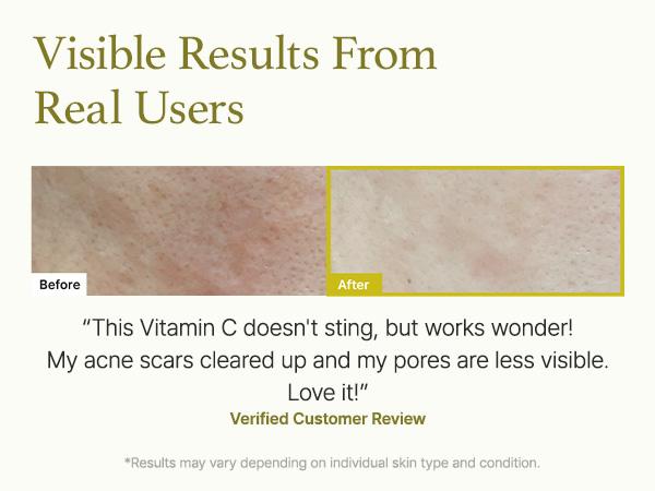 [Arencia Official] Vitamin C Booster Shot, Pure Vitamin C + Glutathione for Bright, Healthy Skin Glow, 1.01 fl oz