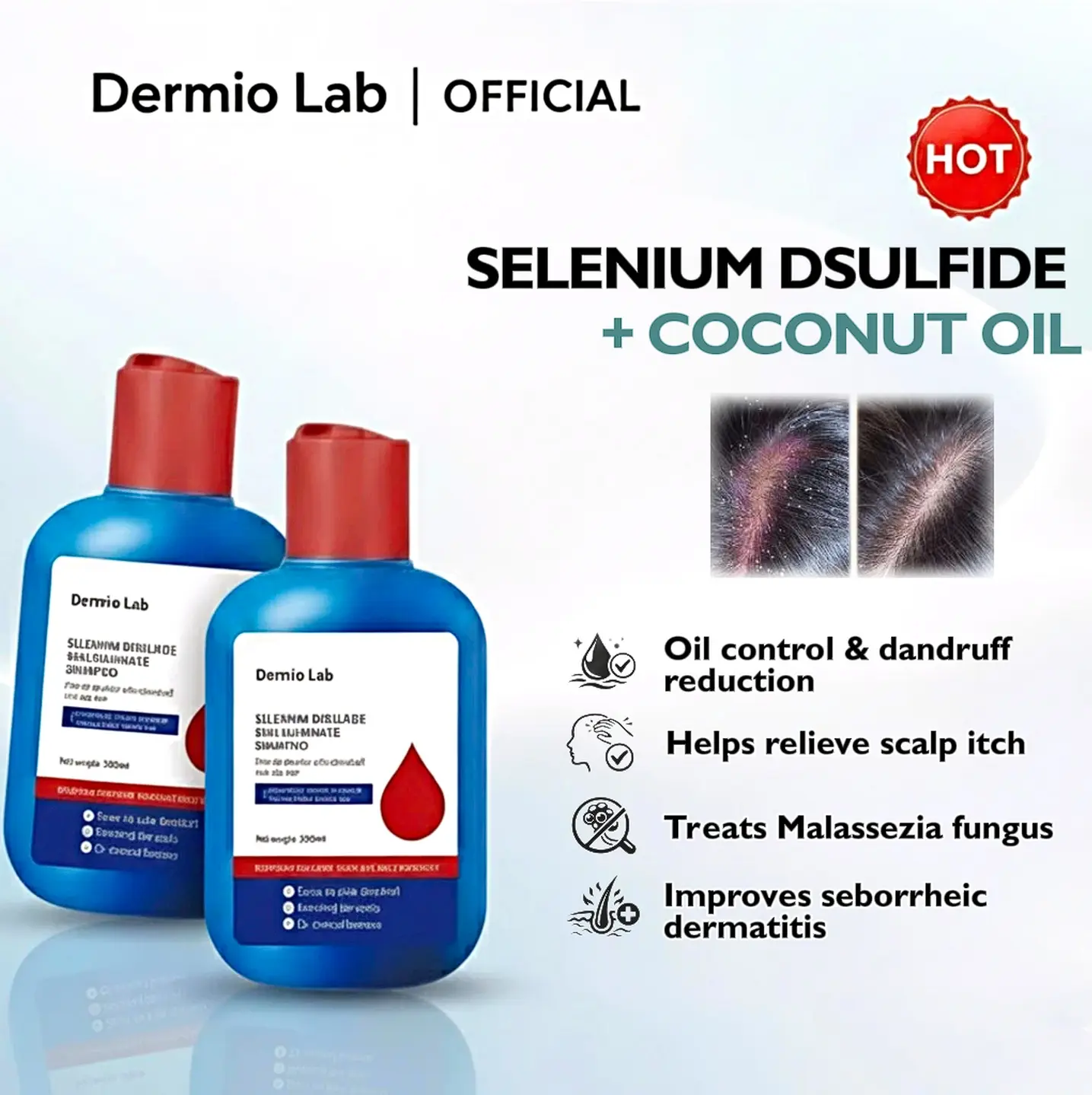 Soothing Coconut Oil & Selenium Disulfide Shampoo & Conditioner for Anti-Dandruff and Oil Control | Calming Itchy Scalp Relief, 300ML, Calming Shampoo
