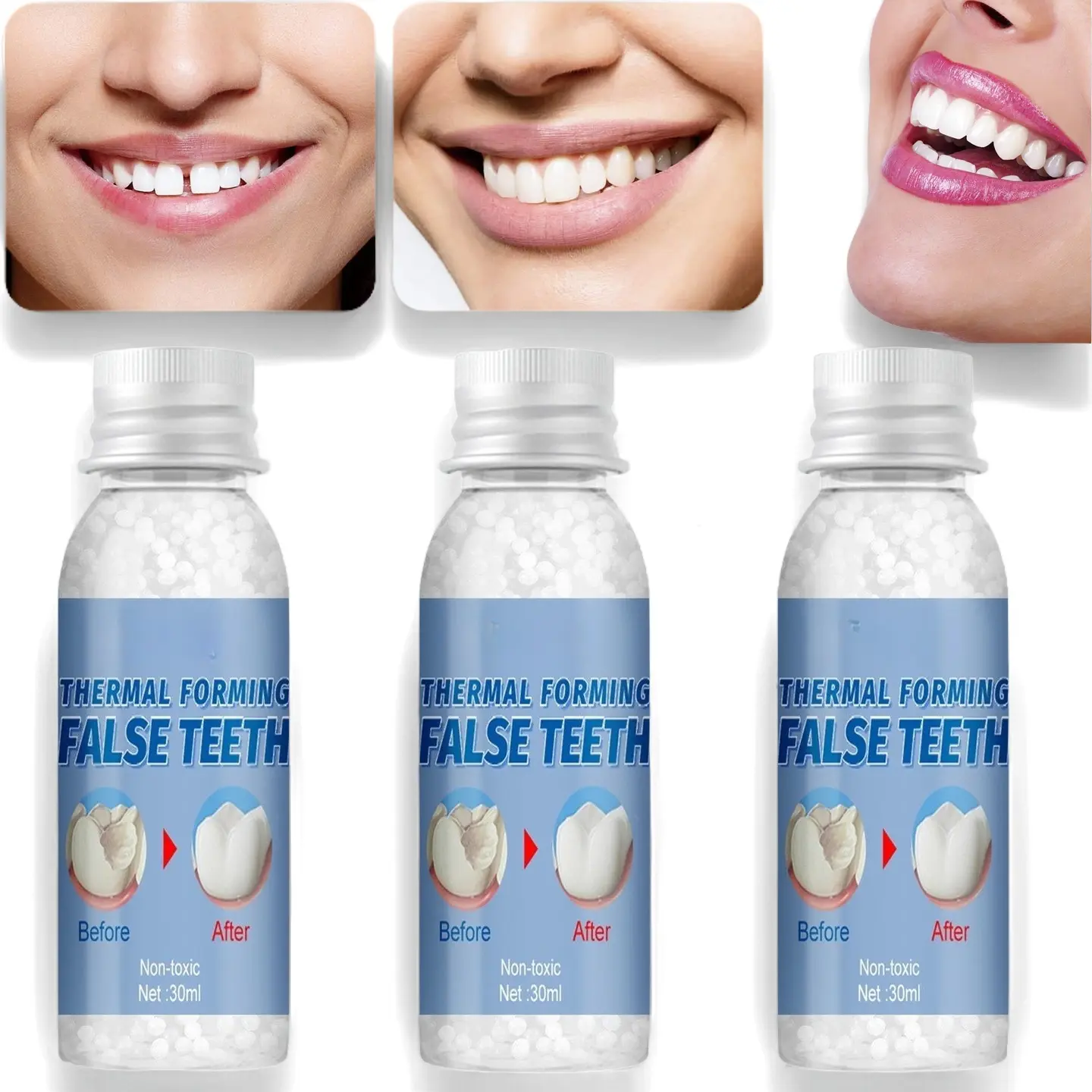 Emergency Tooth Repair Kit - Instant Temporary Filling for Cavities & Broken Teeth | Moldable Adhesive Gel for Gaps & False Teeth | 30ml Quick Fix for Beautiful Smile & Oral Health