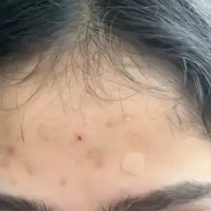 3PCS Lemon Turmeric KojicAcid SoapLemon Kojic Acid Soap BarTurmeric Soap BarKojic Acid SoapDark Spot Remover for Face Facial Skincare Radiant Comfort