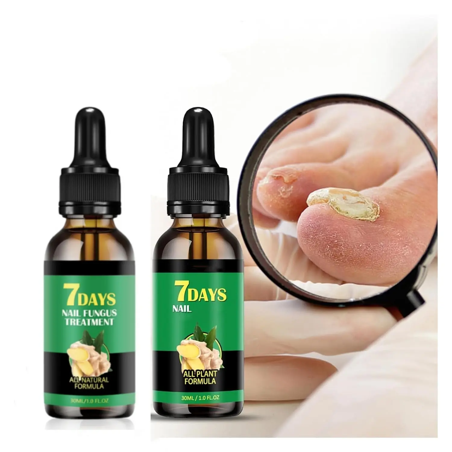 7 Days Fast Acting Nail Fungus Treatment & Nail Growth Oil-Powerful Nail Repair Essence for Damaged Discolored Nails-Cuticle Care Serum Professional Nail Fungus Repair Kit&Healthy Remedies Oils,Suitable for Solving Fungal Nails and Other Nail Problems