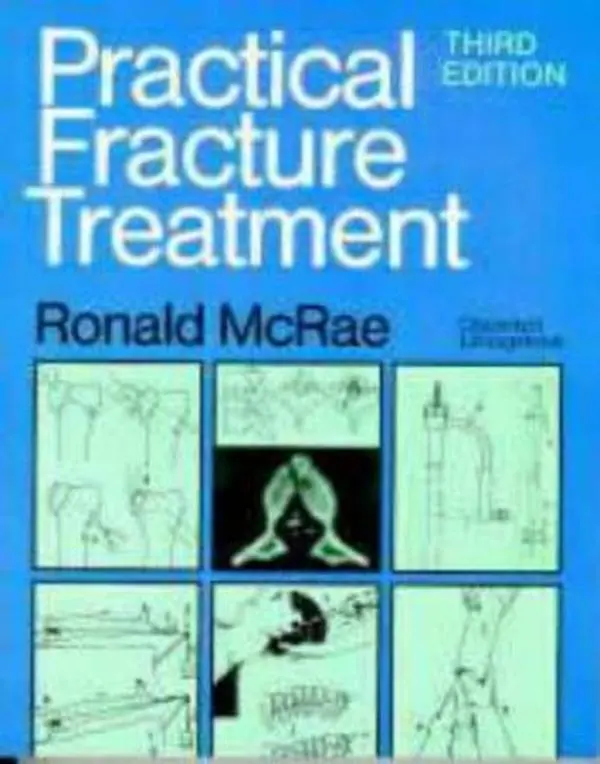 USED Book - Practical Fracture Treatment by Ronald McRae FRCS(Eng  Glas)  FChS(Hon)  AIMBI  Fellow of the British Orthopaedic Association (Paperback) - english